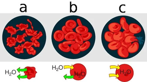 Red blood cells in hypertonic, isotonic and hypotonic solutions.