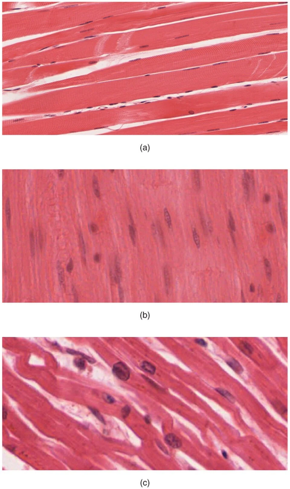 Skeletal, smooth and cardiac muscle.