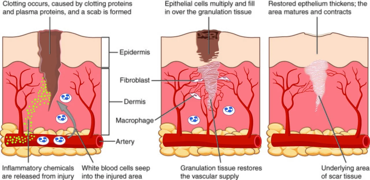 Inflammation, organization and regeneration in a skin wound.