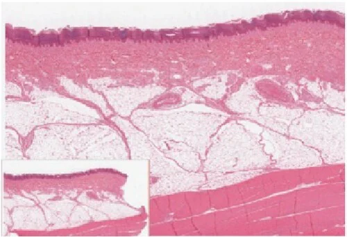 Thick skin (palms, soles) has five layers; thin skin has four (no stratum lucidum).