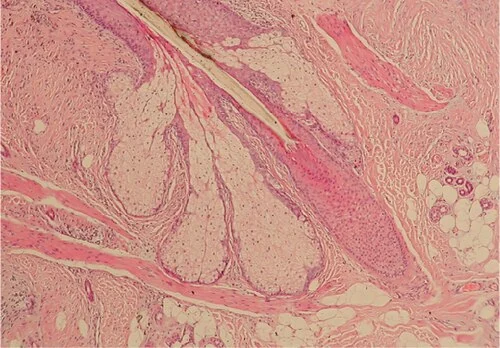 A hair follicle.