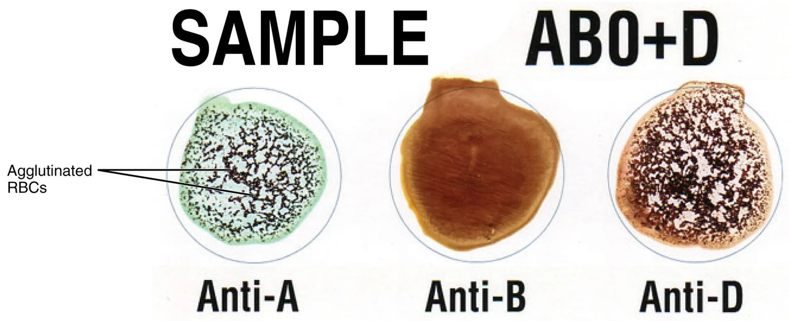 Blood typing and cross-matching.
