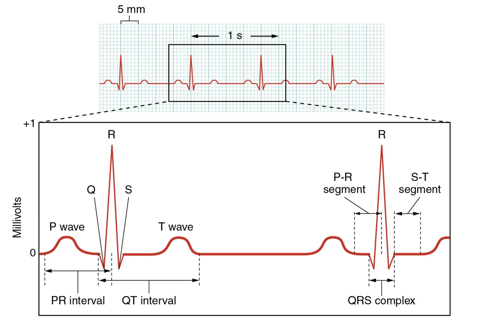 A normal ECG tracing.