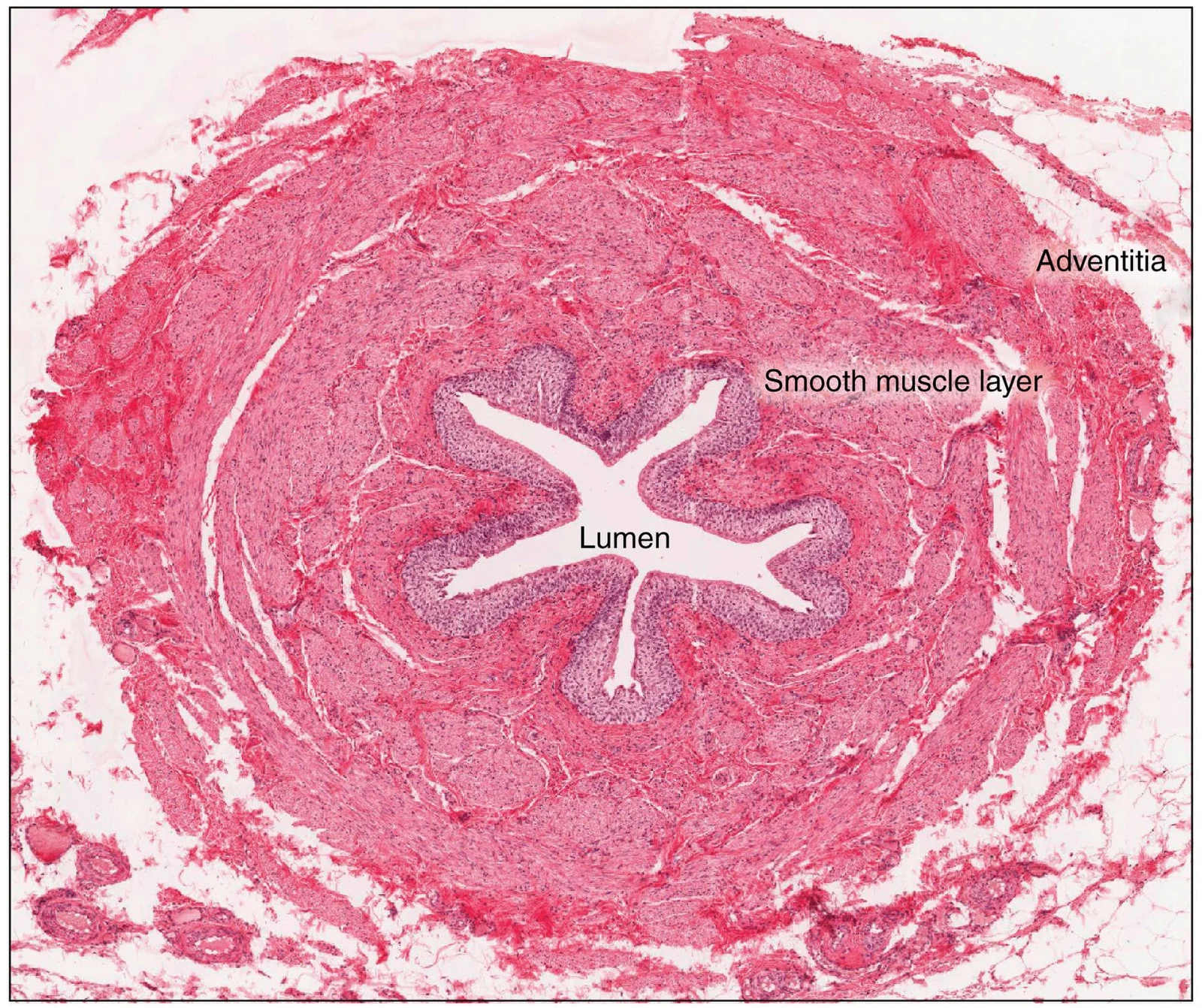 The ureter wall.