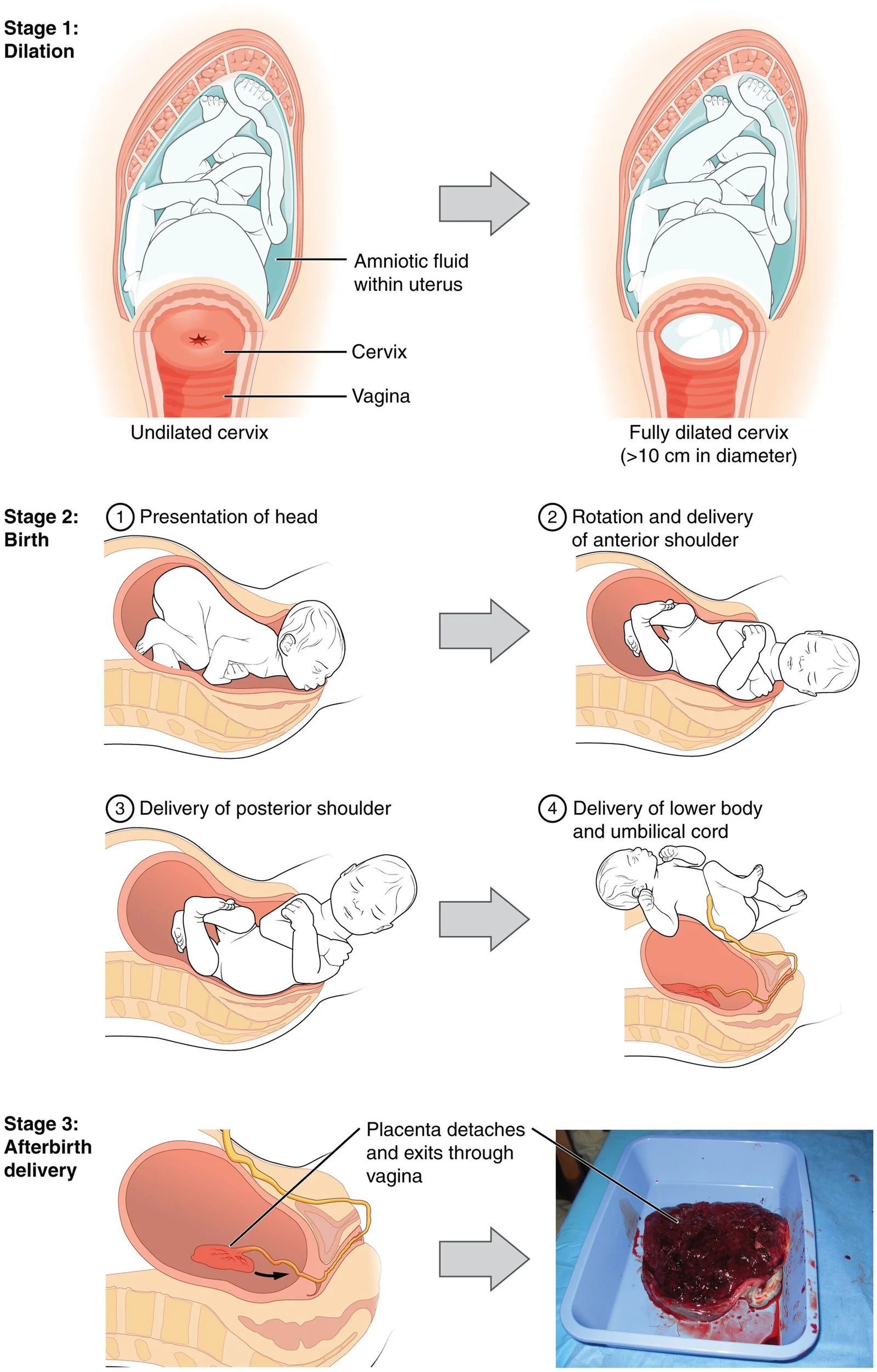 Stages of childbirth.