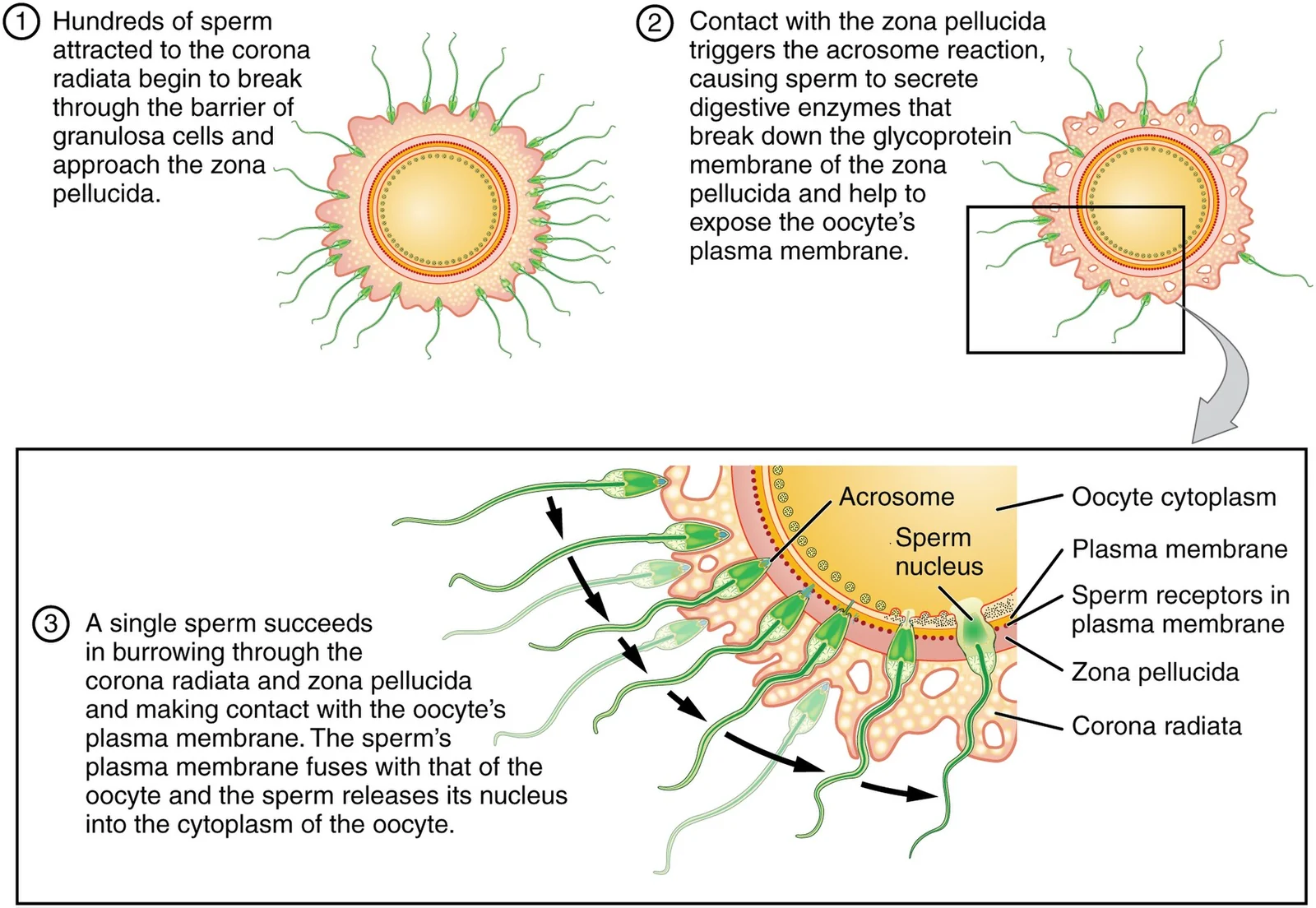 Sperm penetrating the corona radiata and zona pellucida.