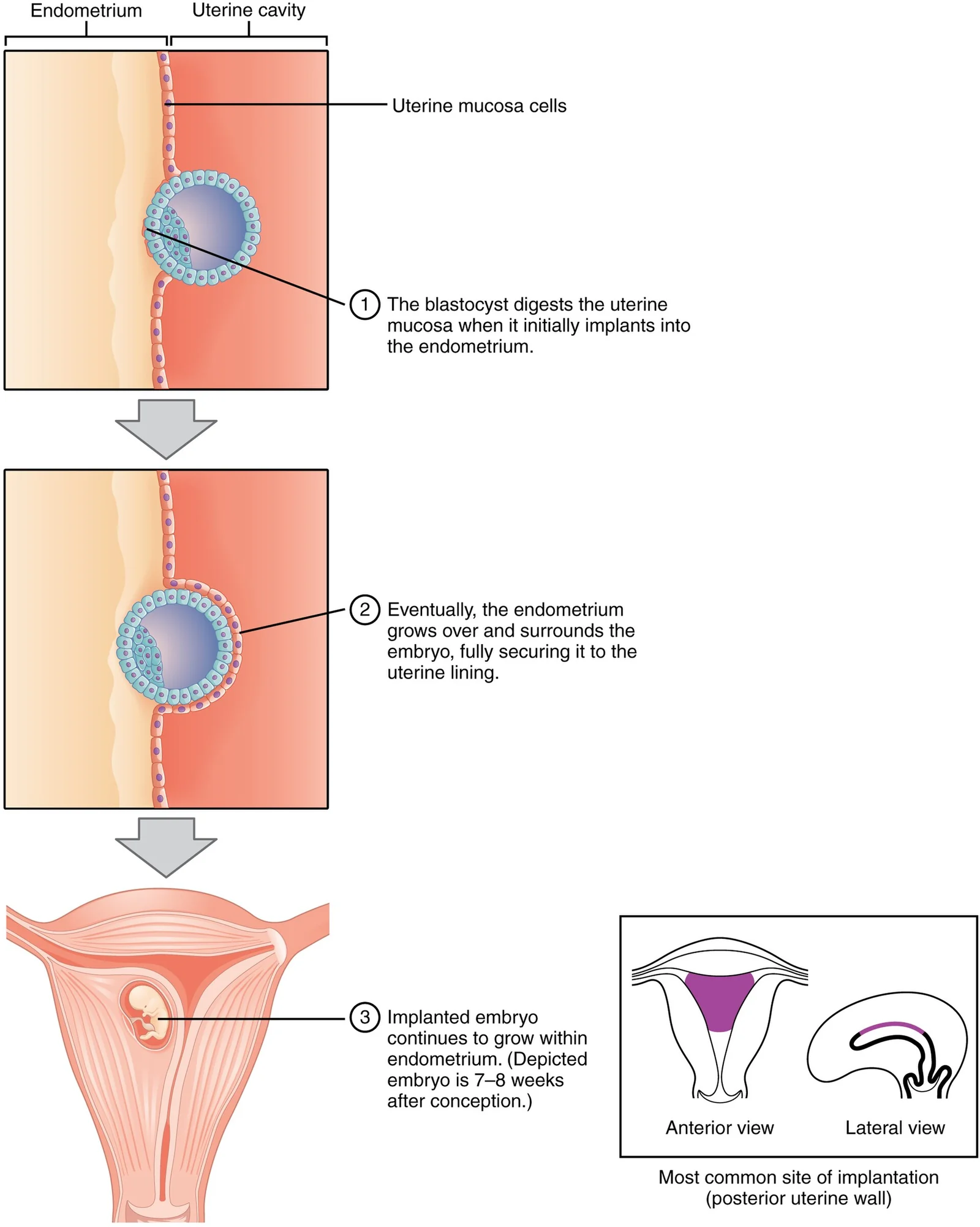 Implantation into the endometrium.