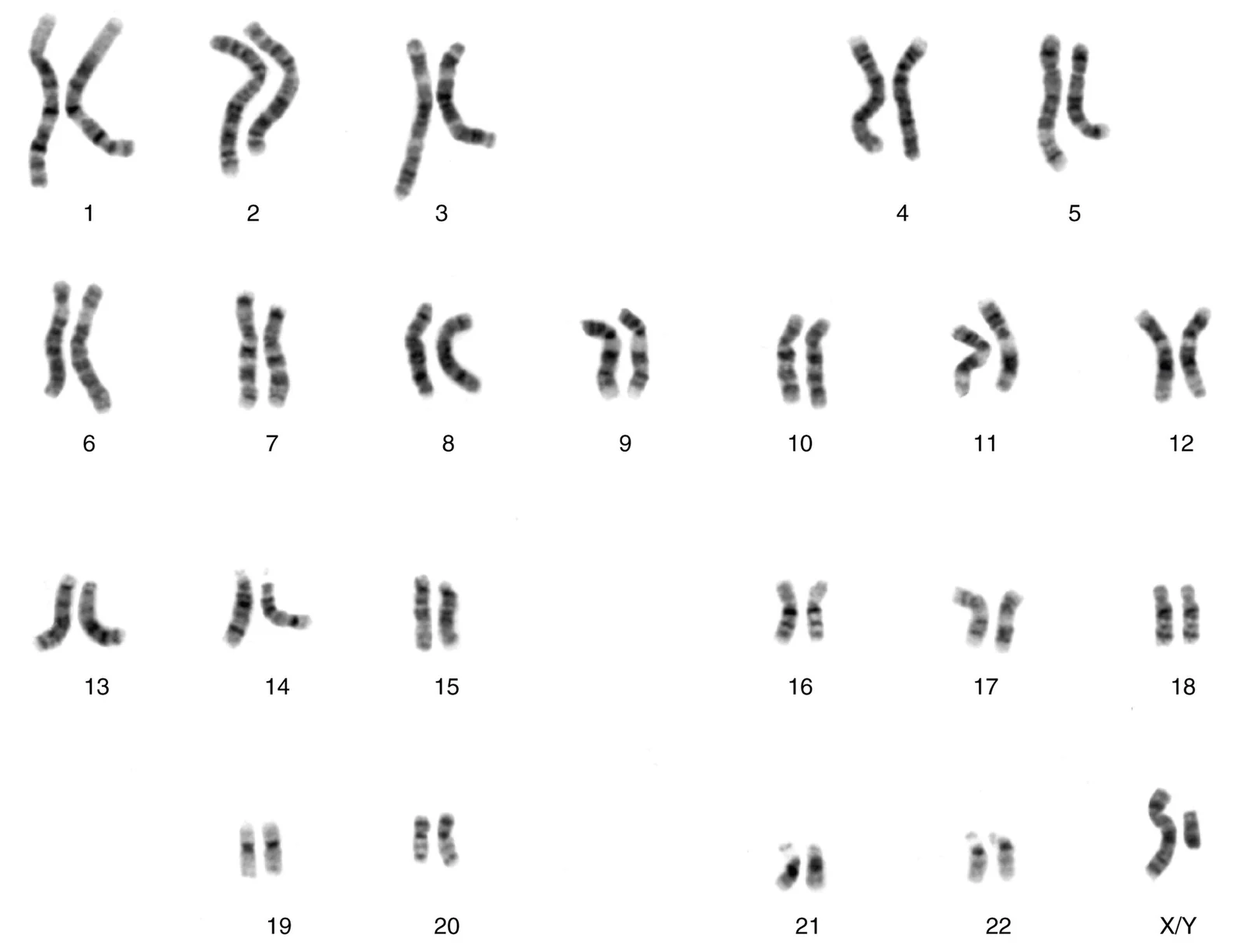 A human karyotype.